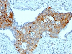 TRIM29 Antibody (TRIM29/1041), Novus Biologicals 0.2mg; Unlabeled:Antibodies,